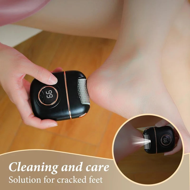 Electric Foot Callus Remover – Rechargeable Pedicure File for Smoother, Softer Feet