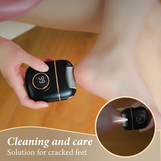 Electric Foot Callus Remover – Rechargeable Pedicure File for Smoother, Softer Feet