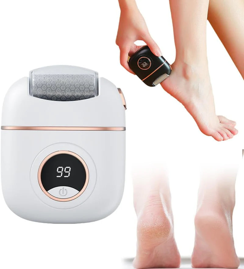 Electric Foot Callus Remover – Rechargeable Pedicure File for Smoother, Softer Feet